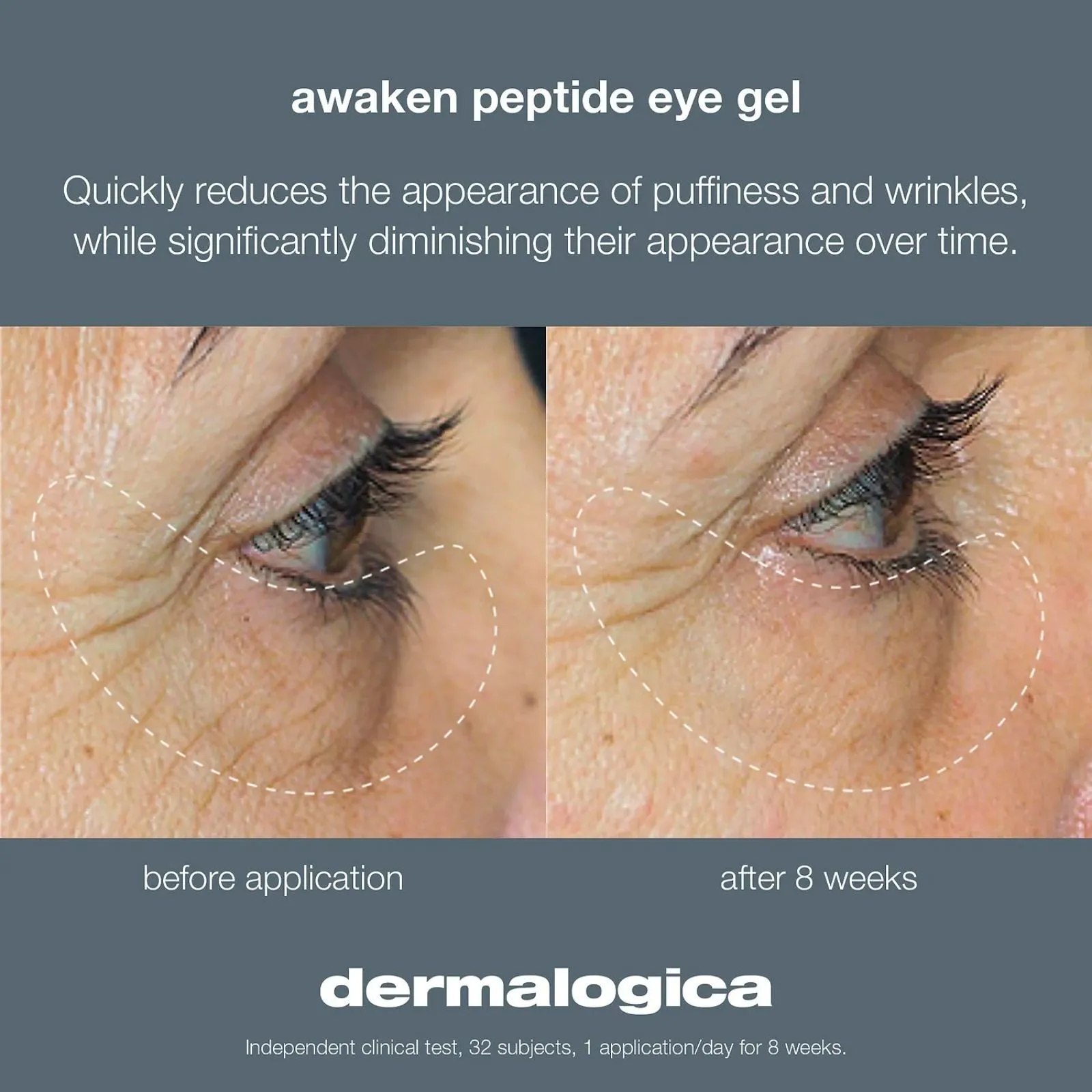 Dermalogica | Awaken Peptide Eye Gel 15ml